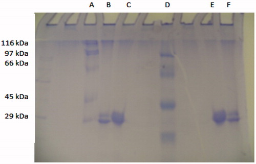 Figure 3. Sodium dodecyl sulphate-polyacrylamide gel electrophoresis (SDS-PAGE) analysis of purified CA I and II isozymes from human erythrocytes. Lane A and D: standard proteins (kD): β-galactosidase from E. coli (116), phosphorylase B from rabbit muscle (97), bovine serum albumin (66), chicken ovalbumin (45) and carbonic anhydrase (29). Lanes B and F: human carbonic anhydrase I. Lanes C and E: human carbonic anhydrase II.