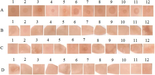 Figure 6. Results of dot-blot assay with sera of 12 patients.Notes: (A) dot-blot with native CPP; (B) dot-blot with CPP treated by temperature; (C) dot-blot with CPP treated by pepsin and (D) dot-blot with CPP treated by the combination of two treatments.