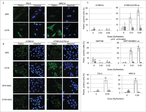 Figure 4. Immunofluorescent staining for Parkin after fractionated radiation (FR). (A) IF localization of Parkin in unirradiated TIG-3 and MRC-5 cells (0FR) and cells irradiated for 31 d (31FR). DNA was stained with Hoechst. (B) Images of Parkin staining in 0FR and 31FR ataxia telangiectasia mutated-deficient cells and complemented cells with and without N-acetyl-L-cysteine (NAC) treatment. (C) Percentage of Parkin-positive cells in indicated cells exposed to 0.01- or 0.05-Gy fractions and exposed to FR plus NAC. Asterisks indicate a significant increase or decrease in the percentage of Parkin-positive cells compared with control 0FR cells.