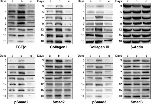 Figure 6 Western blot results of protein expression in the (a) gauze, (b) PVA/COS-AgNPs nanofiber, (c) PVA/COS-AgNPs nanofiber plus SB431542 group at days 3, 5, 7, 9, 12, 15, and 18 after surgery.Notes: TGFβ1 expression was significantly increased in (b) during the initial stage of the healing process and decreased over time. The active forms, phosphorylated Smad2 and 3, were similar to the TGFβ1 protein expression while the “total” Smad2 and Smad3 were not significantly different among the three groups. Collagen I and collagen III expression increased over time, and the highest expression was observed in (b). In contrast, (c) demonstrated the lowest collagen I and collagen III protein expression levels of the three groups during each stage of wound healing. β-actin served as the internal control.Abbreviations: TGFβ1, transforming growth factor-β1; PVA, poly(vinyl alcohol); COS, chitosan oligosaccharide; AgNPs, silver nanoparticles.