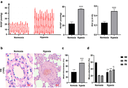 Figure 4. The identification of hypoxia-induced pulmonary arterial hypertension rat model. (a) RVSP and the ratio of RV/(LV + S) were measured in Normoxia group and Hypoxia group. (b) H&E staining was performed in the lung of Normoxia group and Hypoxia group. scale bar = 50 μm. Quantitative measurement of media thickness of pulmonary artery (c) and vessel muscularization (d). Data are present as means±SD (n = 6 rats in per group). *P<0.05 (different from Normoxia group), **P<0.01 (different from Normoxia group), ***P<0.001 (different from Normoxia group), ****P<0.001 (different from Normoxia group).