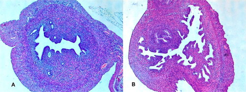 Figure 1. Rat endometrium image at 400× optical magnification. (A) 0.5 mm thick endometrium from the OHSS group. (B) 0.2 mm thick endometrium from the ondansetron treatment group.