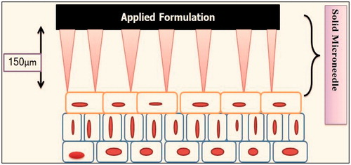 Figure 4. Enhancement of transdermal permeation by microneedle array.
