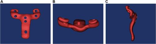 Figure 5 The front (A), top (B) and lateral (C) views of 3D reconstruction model of plate.