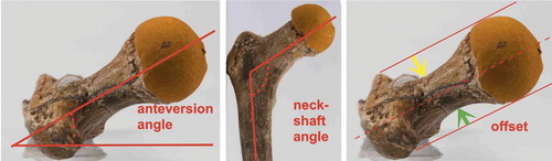 Figure 13. The femoral neck can be characterized by its length, width and the angle it forms with the shaft of the femur in 2 planes (anteversion and neck-shaft angle). Offset: the maximum space between femoral neck and a line drawn parallel to it along the femoral head. Green arrow posterior (dorsal) offset, yellow arrow anterior offset. Anterior/cranial is up, lateral is to the left. Lines drawn on cast of femur of Turkana Boy, a 15 year old Homo erectus that lived 1.5 mya (Table 4).