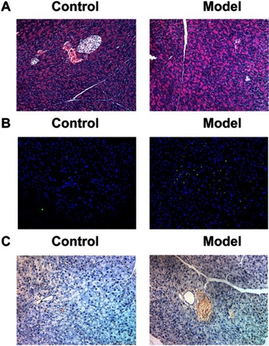 Figure 2 Pancreatic beta-cell count and IL6R expression in the diabetic rat pancreas tissues. (A) The number of pancreatic beta-cell observed by hematoxylin-eosin staining. (B) The apoptosis of pancreatic beta-cell observed by TUNEL staining. (C) IL6R expression observed by immunohistochemistry.