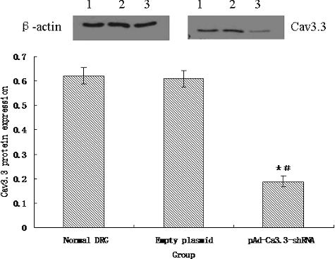 Figure 6. Expression of Cav3.3 protein. Lane 1: expression of Cav3.3 protein in normal DRG cells; Lane 2: expression of Cav3.3 protein in empty DRG cells; Lane 3: expression of Cav3.3 protein in pAd-Cav3.3 shRNA adenovirus-infected DRG cells.