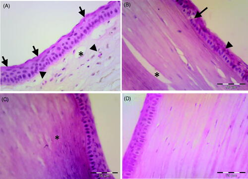 Figure 4. Photomicrograph of the corneal tissue of adult male albino rabbits 14 days after carrageenan injection. (A) Group I, non-treated cornea showing increase in epithelial thickness and appearance of horny superficial layer on the corneal surface (arrow), inflammatory cells could be observed in the stroma (arrowhead), as well as newly formed blood vessels (*). (B) Group II (plain drug hydrogel) showing vacuolated epithelial cells (arrow), eosinophilic cytoplasm of others (arrowhead) and stroma showing improved organization of collagen (*). (C) Group III (micellar solution) showing nearly normal epithelial pattern. Stroma showing homogenization of collagen (*). (D) Group IV (TA micelles/chitosan hydrogel) showing nearly normal appearance of the cornea with normal epithelial arrangement and normal stromal pattern. H&E scale bar 50 µm.