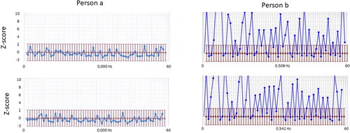 Figure 1 Example of visual presentation of MCS test performance.Note: The graph shows 60 consecut ve pause times (horsontal X-axis) and their duration transformed to z-scores (vertical y-axis). The red bars denote ±2 standard deviations (SD) of z-scores. Note that all pause times of this individual (person a) blue dots lie below 2 SD: s of typical performance. The performance is denoted below the curve as 0.000 Hz (i.e., the number of aberrant pauses is 0/60 = 0.000 Hz).Characteristic aberrant response patterns from an normal adult (person a) and an adult with attention deficit and reading disability (person b). Note that many z-scores exceed 2 SD: s in both trials.