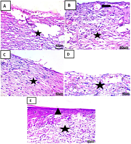 Figure 14 Photomicrographs of skin sections treatment at 7th day in each group (H & E x 400): (A) showing fibrous connective tissue formation with hemorrhage and infiltration by mononuclear inflammatory cells (star). (B) showing well-organized fibrous connective tissue with infiltration by mononuclear inflammatory cells (star) and formation of newly formed blood vessels (arrow). (C) showing fibrous connective tissue formation with infiltration by mononuclear inflammatory cells (star). (D) showing fibrous connective tissue formation with mononuclear inflammatory cells and hemorrhage (star). (E) shows the formation of well-organized fibrous connective tissue with infiltration by mononuclear inflammatory cells (star) covered by some epidermal layer formation (arrowhead).