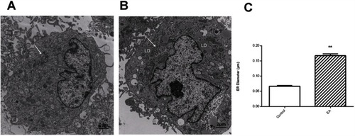 Figure 4 ER stress induced by EA in human mature adipocytes. (A) Control group; (B) treated with 100 μmol/L of EA for 24 hrs; (C) quantitative analysis of ER luminal diameter, as a surrogate marker for ER stress per cell using transmission electron microscope images. Results are representative averages of at least six images performed from three independent experiments and are displayed as mean ± SD. **P<0.01. White arrow shows the ER lumen.