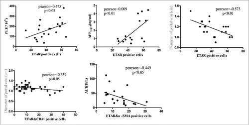 Figure 6. Correlation analysis of ETAR positive cells and clinical indexes. Liver function index included alanine transaminase (ALT), α fetoprotein (AFP), and platelet count (PLT).