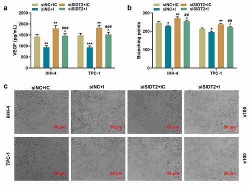 Figure 9. Co-transfection of siSIDT2 and miR-31-5p I regulated the contents of VEGF in supernatant of PTC cells and angiogenesis of HUVECs