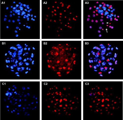 Figure 2.  Blastocysts stained using trophectoderm (TE) permeabilization. Column 1 (A1, B1, C1) shows all blastocyst nuclei stained with Hoechst 33258 (blue). Column 2 (A2, B2, C2) shows TE nuclei stained with propidium iodide (PI, red). Column 3 (A3, B3, C3) shows merged images where TE nuclei are pink and inner cell mass (ICM) nuclei are blue. A1-A3) correctly stained blastocyst. Arrowhead points to the condensed chromatin of the second polar body and arrow indicates a dividing TE cell. B1-B3) incorrectly stained blastocyst showing poor PI staining, probably due to insufficient permeabilization of TE cells. C1-C3) incorrectly stained blastocyst showing PI staining in all nuclei, probably due to excessive cell permeabilization.