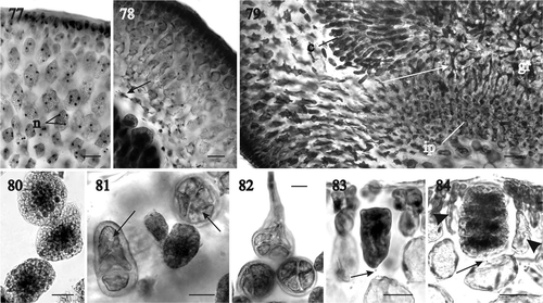 Figs 77–84. Sarcodia grandifolia. Development of cystocarp and tetrasporangia. Haematoxylin. 77. Surface layer and inner cells of the outer pericarp (NCU 591799-802). 78. Mature cystocarp showing the slightly stellate cells (arrow) in the outer pericarp surrounding the gonimoblasts (NCU 591799-802). 79. Basal part of a cystocarp showing the relationships between inner and outer pericarp and the gonimoblast filaments (arrow) (NCU 591803-811). 80. Mature uninucleate carposporangia (NCU 591799-802). 81. Carposporangia and in situ germinating carposporangia (arrows) (NCU 591803-810). 82. In situ germinating carposporangia (NCU 591803-811). 83. Tetrasporangium linked by a basal pit connection (arrow) to a subcortical cell (WELT A030183). 84. Mature zonately divided tetrasporangium pit-connected basally (arrow) to a subcortical cell and flanked by elongated cortical filaments (arrowheads) (WELT A030183). Abbreviations: c: carposporangia; ip: inner pericarp; n: nucleus; gr: gonimoblast reticulum. Scale bars: 20 µm (Figs 77, 78, 81–84), 50 µm (Fig. 79) or 10 µm (Fig. 80).
