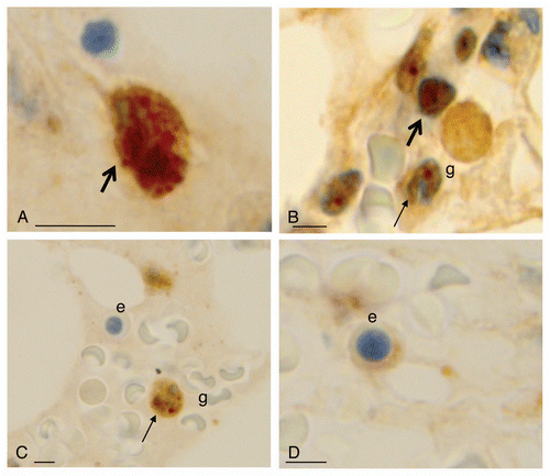 Figure 5 FoxO3 expression within normal hematopoietic cells. (A) FoxO3 expression is seen in the cytoplasm or nucleus of myeloid progenitor cells (thick arrows). (B and C) FoxO3 expression in more mature granulocytes (g): these mature cells show a nuclear dot-like positivity, specifically in the chromocentric regions (thin arrow of B). (C and D) FoxO3 expresion in erythroid precursors (marked as e) with very dim (D) or negative (C) expression of cytoplasmic FoxO3. The reticle bar represents ∼10 µ in each figure.