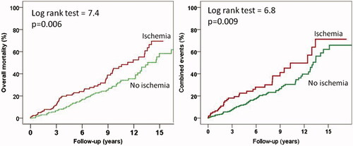 Figure 3. Overall mortality curves (A) and combined events curves (B) for patients with and without ischemia during exercise echocardiography.