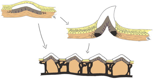 Figure 1. The origin of bone. Precipitation of hydroxyapatite around the basal membrane of the skin gave rise to enamel- and dentine-like tissues that formed odontodes, which became the progenitors of teeth and scales. Spread of mineralization deeper in the dermis formed shields consisting of acellular—and later cellular—bone. (Adapted from Donoghue et al. Citation2006).