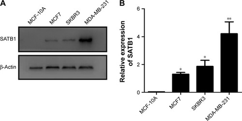 Figure 7 SATB1 expression correlates with the invasiveness of breast cancer cell lines.