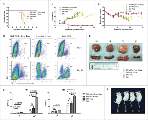 Figure 4. Bregs preserve the (T)cell-mediated GVL effect while inhibiting GVHD. Lethally irradiated BALB/c recipients were transplanted with B6 TCD-BM, with or without T cells, and challenged or not with leukemia cells (5 × 105/mouse). Bregs were injected at the time of transplantation. (A) Survival was monitored over time. (B) Recipient mice were assessed every 2 d for clinical severity of GVHD; clinical scores are shown. (C) Mean percentage initial body weight of recipients over the first 30 d. (D) A representative dot plot for GFP+ leukemia cells. (E) GFP+ leukemia cells in peripheral blood and bone marrow were counted by flow cytometry on days 7 and 14. (F) On day 14, mice from different groups were killed, and autopsy was performed to observe the enlargement of liver (upper panel) and spleen (lower panel). (G) Comparable mouse general physical status was found in the Breg injection group and bone marrow-transplanted group. From left to right, TCD-BM + T cells + leukemia cells + Breg, TCD-BM + T cells + leukemia cells, TCD-BM + leukemia cells, TCD-BM. Results are representative of three independent experiments with three mice per group per experiment. Data are mean ± SEM. *p < 0.05, **p < 0.01, ***p < 0.001, ****p < 0.0001.