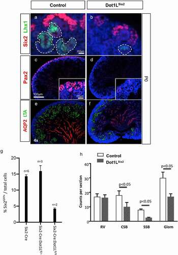 Figure 6. Dot1LSix2 kidneys exhibit depletion of nephron progenitors and nascent nephrons. Section immunofluorescence using markers of nephron progenitors (Six2, Pax2), nascent nephrons (Pax2, Lhx1), maturing proximal tubules (LTL) and collecting ducts (AQP2). Dot1LSix2 kidneys show marked downregulation of Six2, Lhx1 (a, b) and Pax2 (c,d) expression. There is a concomitant reduction in LTL-positive proximal tubules and secondary diminution of collecting ducts (e, f). (g) Quantitation of Six2 progenitors was performed using FACS of Six2GFP cells (see methods) and expressed as the percent of GFP+/total cells. (h) Quantitative analysis of nascent nephrons in Dot1LSix2 kidneys at E17.5 (N = 7–8/group). Counts were performed on 3 alternating sections per kidney (n = 4–5 mice per group). RV: renal vesicles; CSB: Comma-shaped nephrons; SSB: S-shaped nephrons; Glom: maturing glomeruli. Means SEM