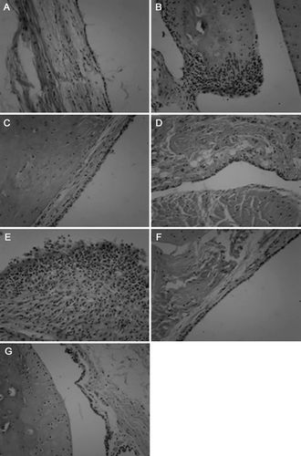 Figure 5.  The effect of AR-6 on histological changes in CIA rats. Representative histopathological lesions using hematoxylin and eosin stain of hind ankle joint are shown: (A) control group, (B) model group, (C) AR-6 high dose group, (D) AR-6 middle dose group, (E) AR-6 low dose group, (F) MTX group and (G) TGP group. Original magnifications, ×400.