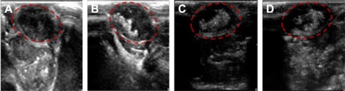 Figure 11 Ultrasound images of subcutaneous tumors (red circles) in BALB/c nude mice.Notes: (A) 0 second, (B) 30 seconds, (C) 10 minutes, and (D) 120 minutes after injection of lactoferrin-conjugated poly(aminoethyl ethylene phosphate)/poly(L-lactide) nanobubbles.
