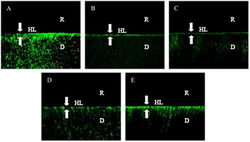 Figure 3 Typical images of quenched fluorescein-conjugated gelatin substrates of each group. (A) No pretreatment; (B) Pretreatment with PA/ethanol solution; (C) Pretreatment with myricetin/ethanol solution; (D) Pretreatment with resveratrol/ethanol solution; (E) Pretreatment with kaempferol/ethanol solution. R = resin, D = dentin, HL = hybrid layer (between arrowheads).