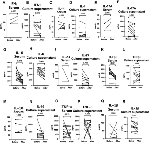 Figure 6 Cytokine profiles in patients with TAK before and after immunosuppressive therapy. (A) IFN-γ in serum (B) IFN-γ in culture supernatant (C) IL-4 in serum (D) IL-4 in culture supernatant (E) IL-17A in serum (F) IL-17A in culture supernatant (G) IL-6 in serum (H) IL-6 in culture supernatant (I) IL-23 in serum (J) IL-23 in culture supernatant (K) TGF-β1 in serum (L) TGF-β1 in culture supernatant (M) IL-10 in serum (N) IL-10 in culture supernatant) (O) TNF-α in serum (P) TNF-α in culture supernatant (Q) IL-1β in serum (R) IL-1β in culture supernatant. Wherever cytokines were undetectable, the lower limit of the detectable range for the ELISA kit was used for graphical representation of data. Data are presented for 16 pairs for serum cytokines and 12 pairs for culture supernatant for IFN-γ, IL-4, IL-17A, IL-6, IL-23, TGF-β1, IL-10, TNF-α; for 13 pairs for serum cytokines and 13 pairs for culture supernatant for IL-1β. Comparisons are present before and after treatment (p values presented for Wilcoxon matched pairs signed rank test after Bonferroni-Sidak correction). p values <0.05 are highlighted in bold. Median duration of follow-up 0.21 (0.13–2.52) years. All patients had been treated with corticosteroids (ongoing in 15/16 at follow-up sample collection). 9 were on tacrolimus alone, 2 were on tacrolimus and methotrexate, one was on methotrexate alone. At the time of follow-up sample collection, disease activity had ceased clinically in 14/16 patients.