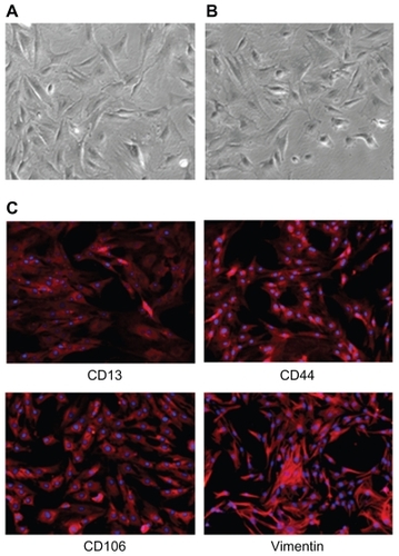 Figure 3 (A) Mesenchymal stem cells before transfection. (B) Mesenchymal stem cells after transfection. (C) Surface markers used to identify mesenchymal stem cells; CD13, CD44, CD106, and vimentin were all positive, as revealed by red fluorescence.