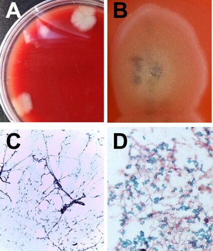 Figure 3. Identification of bacterial isolates from an 8-year-old, spayed, female Maltese dog with infective endocarditis. Initial bacterial colony morphology (A) on the blood agar plate after enrichment in blood culture bottles under aerobic and anaerobic incubation conditions. Close-up appearance of characteristic Bacillus amyloliquefaciens colonies (B) grown on blood agar plates (see white, fluffy, wool-like appearance of the colony). Gram-staining (C) and spore-staining (D) of the bacteria grown on the nutrient agar surface (C) and in nutrient broth (D). The results of the bacterial strain showed that the bacteria were somewhat entangled, forming filamentous branches (C). Numerous malachite green-stained Bacillus spores were formed in the broth (D).
