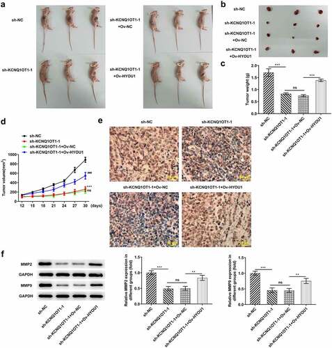 Figure 9. KCNQ1OT1 knockdown impeded tumor growth and metastasis by inhibiting HYOU1. (a) Representative morphologies of nude mice xenograft models. (b) Representative morphologies of xenograft tumors. (c) Weights of xenograft tumors. (d) Tumor volume curve. (e) Immunohistochemical staining examined Ki-67 expression in xenograft tumors. (f) Western blotting analysis detected expressions of MMP2 and MMP9 in xenograft tumors