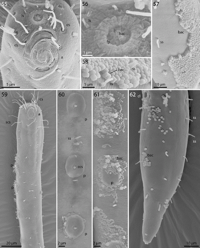 Figs. 55–62. Robbea agricola sp. nov. 55. Male, head in face view; 56. Mouth opening with fingerlike papillae; 57. Annulation and bacterial coat in midbody region; 58. Coat of corn-kernel shaped bacteria; 59. Male, anterior body region with the first part of the row of sucker-shaped papillae; 60. Papillae; 61. Papillae surrounded by bacterial growth; 62. Female, tail. SEM.