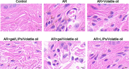 Figure 5 Histopathological changes in the nasal mucosa of rats were investigated by hematoxylin-eosin (HE) staining (400×).