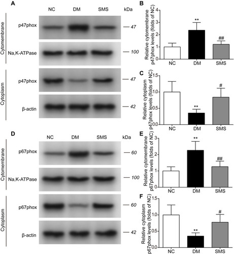 Figure 5 SMS inhibits NOX translocation in DM rats. The subcellular levels of p47phox and p67phox protein in heart tissues from different groups were detected by Western blot, and representative bands are shown in (A and D). The levels of cytomembrane and cytoplasm p47phox (B and C), and cytomembrane and cytoplasm p67phox (E and F) were normalized to the NC group. The results are presented as means ± standard deviations. **p<0.01 vs the NC group, # p<0.05 vs the DM group, and ## p<0.01 vs the DM group (n = 6 rats per group).