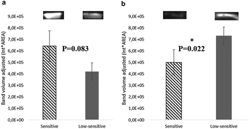 Figure 4. Representative Western blot analysis of cystatins S-SA-SN (a) and CA VI (b) in mixed saliva samples of individuals with different sensitivity levels to sweet taste (mean ± SEM).*Statistically significant differences: P < 0.05.