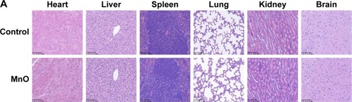 Figure 7 (A) HE-stained tissue sections from mice harvested at 28 days after the single injection of pure saline (control) or MnO-PEG-Cy5.5 (35.0 mg Mn/kg), respectively. Tissues were harvested from heart, liver, spleen, lung, kidney and brain. (B) Relative viabilities of NRVMs, H9c2, and CFs incubated with various concentrations of MnO-PEG-Cy5.5 nanoparticles (0–100 µM Mn). Data are expressed as means ± SD of four independent experiments.Note: Scale bar=100 µm.Abbreviations: CFs, cardiac fibroblasts; HE, hematoxylin-eosin; NRVMs, neonatal rat ventricular myocytes.