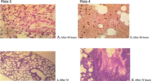 Figure 4. Plate 3(a and b): Penicillium chrysogenum (2.3 × 107): There are severe widespread haemorrhages into the alveoli. There are a few foci of formation of giant cells. Plate 4(c and d): Penicillium chrysogenum (3.2 × 105): There is extensive severe thickening of alveolar interstitium. There are numerous foci of macrophages laden with dark pigments. Numerous unstained clear fungal hyphae are trapped in the necrotic debris. There is moderate congestion of blood vessels.