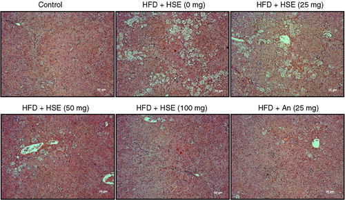 Fig. 1 Effects of Hibiscus sabdariffa water extract (HSE) supplement on body weight and adipose tissue in HFD-fed hamsters. H and E staining of liver sections shows various degrees of fat accumulation in hamsters fed a normal diet (control) and hamsters fed with HFD along with different amounts of HSE or 25 mg anthocyanin.