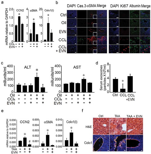 Figure 4. Normalization by EVN of hepatic gene expression or serum components during CCl4- or TAA-induced liver fibrosis in vivo. Male TG CCN2-EGFP mice were administered oil (1500 μl /kg) or CCl4 (175 μl in 1325 μl corn oil /kg) i.p. for 5 weeks, with or without EVN (40 μg/g; i.p.) every other day over the last 2 weeks. Animals were then sacrificed and examined by (a) qRT-PCR of hepatic mRNA for expression of CCN2, αSMA, or collagen α1(I) (n = 4 independent experiments performed in triplicate. * p < 0.01 versus no treatment)) or (b) IHC of liver sections for the presence of caspase 3 or αSMA (left panel) or Ki67 or albumin (right panel) (typical staining from 5 independent experiments). Serum from blood collected at the time of sacrifice was (c) assayed for ALT or AST or (d) subjected to NTA to determine EV frequency. Male FVB mice received TAA (i.p. 200μg/g; q.o.d.) for 6 wks with or without daily i.p. administration of EVN (40μg/g; isolated from serum of normal FVB mice) for 6 days during the last week after which  (e) hepatic RNA underwent qRT-PCR for fibrosis-related gene expression in livers or (f) liver sections were stained with H and E or with anti-collagen α1 (orange) and DAPI (blue). n = 5 independent experiments performed in triplicate. *p < 0.01 versus no treatment. Scale bar: 20 μm.
