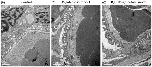 Figure 4. Effect of Rg1 on the ultrastructure of glomerulus of d-galactose model mice.