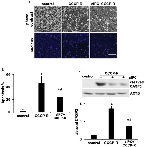 Figure 6. In vitro sIPC attenuates prolonged CCCP-induced apoptosis in RPTC cells. In vitro sIPC was induced by incubating RPTC cells with 20 μM CCCP for 30 min followed by 40 min of recovery. The cells were then treated with prolonged CCCP (20 μM) for 3 h followed by 2 h of recovery to model in vivo renal IRI. Cells were collected for analysis of apoptosis by morphology and caspase activation. (a) Representative images of phase contrast and fluorescence microscopy showing cellular and nuclear morphology of apoptosis. Scale bar: 200 μm. (b) Quantification of cell apoptosis. (c) Representative blots and densitometric analysis of cleaved CASP3. ACTB was used as a loading control. After normalization with ACTB, the protein signal of the control was arbitrarily set as 1, and the signals of other conditions were normalized to the control to calculate fold changes. Data in (b and c) are expressed as mean ± SD. *, P < 0.05, significantly different from the control group; #, P < 0.05, significantly different from CCCP-R group.