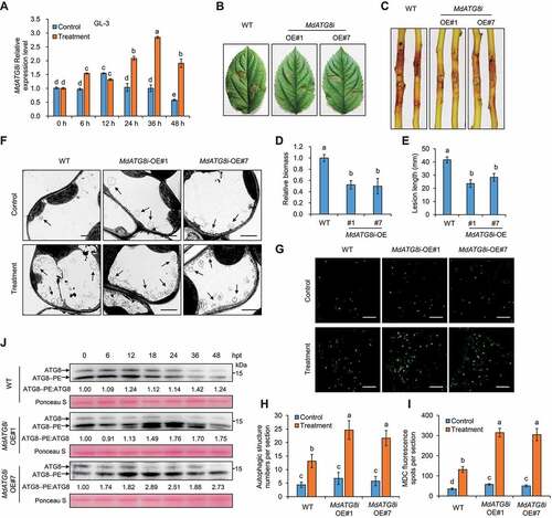 Figure 1. Overexpression of MdATG8i induced autophagy and autophagosome formation, which positively regulates resistance against V. Mali. (A) The relative transcript levels of MdATG8i in GL-3 at different stages during V. Mali infection were determined by RT-qPCR. MdEF1a was used for normalization. Control, sterile potato dextrose agar (PDA) medium; Treatment, V. Mali-infected leaves. (B and C) Representative disease symptoms of detached leaves and stems in GL-3 (WT) and transgenic lines overexpressing MdATG8i (OE#1 and OE#7) infected with V. Mali and photographed at 3 d and 7 d, respectively. (D and E) Statistical analysis of the relative fungal biomass of diseased leaves in (B) and the length of the necrotic regions of stems in (C) based on three independent biological replicates with at least 15 infected leaves or stems per replicate. (F) Representative transmission electron microscope (TEM) images of autophagic structures in leaves of WT and MdATG8i OE plants at 24 h post-treatment under control or treatment conditions. Arrowheads indicate the ultrastructure of autophagic bodies inside the vacuoles. Scale bar: 2 μm. (G) MDC-stained autophagosomes in leaves of WT and MdATG8i OE plants at 24 h post-treatment under control or treatment conditions visualized by fluorescence confocal microscopy. Scale bars: 20 μm. (H and I) Quantification analysis of the numbers of autophagic structure and punctate MDC-stained spots per section described in (F and G) with at least 10 individual images acquired from different leaf areas. Data represent means ± SD, n = 3. Different letters above each bar indicate significant differences at P < 0.05 based on one-way ANOVA followed by Tukey’s test. (J) Immunoblotting of the ATG8 protein level in total proteins extracted from transgenic MdATG8i OE#1, OE#7, and WT leaves infected by V. Mali. The non-lipidated and lipidated forms of ATG8 are indicated by ATG8 and ATG8–PE, respectively; hpt, hours post-treatment. Ponceau S staining of the membrane is shown as a loading control.