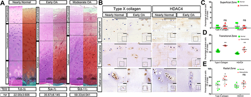 Figure 1 Chondrocyte hypertrophy during human OA development. (A) HE and SafO staining of knee cartilage at different osteoarthritis (OA) stages. The different Mankin Score ranges which classified OA stages were listed in brackets. The superficial zones of human cartilage were wearing off and the radial zones were thickening along with the increase of OA severity. Interestingly, the average age of the samples in different level of OA was also increasing. The dashed lines depict the boundaries between the superficial, transitional and radial zones. The average age of the human samples in different stages of OA was shown as mean±SD. Scale bars:100μm. (B) Immunohistochemistry for histone deacetylase 4 (HDAC4) and type X collagen of Nearly Normal and Early OA patient knee cartilage. Type X collagen expression is localized in the transitional and radial zones, paralleling the staining pattern of HDAC4. Scale bars:50μm. (C–E) Positive cell ratio of type X collagen and HDAC4 in different zones of normal and OA patient knee cartilage. (C) superficial zone; (D) transitional zone; (E) radial zone, n=6 for both groups; *P <0.05,**P <0.01, Student’s t-test.