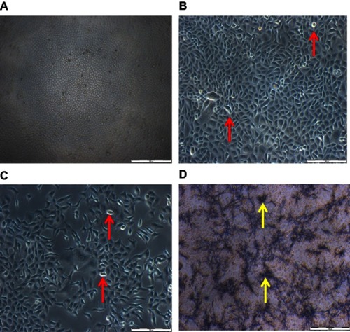 Figure 7 Morphology of MCF-7 cells treated for 48 hrs with DOX as well as doxorubicin nanoparticles (DOX-NPs). (A) Control cells (untreated). (B) Cells treated with free NPs. (C) Cells treated with DOX. (D) Cells treated with DOX-NPs. Red indicators portray cell shrinkage with detachment; yellow arrows portray DOX-NPs coacervates (scale bar: 100 µm).