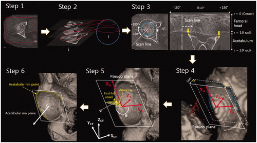 Figure 2. An algorithm for determining the acetabular rim plane, which consisted of six steps. Step 1: Specifying the ROI for each femoral head (Red box). Step 2: Identifying a best-fit sphere (blue) using planar circles (red) detected by SHT. Step 3: Reconstructing each slice using the scan line. The yellow points detected by the corner detection algorithm were candidates for the acetabular rim points. Step 4: Generating the pseudo plane and acetabular coordinate system. The blue points were selected by a RANSAC algorithm; the red points were determined as outliers. The pseudo plane (dashed line) was determined by blue points, and the plane (solid line) was obtained by moving the pseudo plane 1 cm in the direction of -ZA. Step 5: Determining the true acetabular rim points. The true rim point was defined by a virtual ray. The direction of the virtual ray was adjusted by changing the azimuth (θ) and angle (φ). The first-hit voxels were defined as the true rim points. Step 6: The plane fitting the acetabular rim points (yellow) determined the true acetabular rim plane (white).