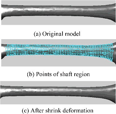 Figure 15. Deformation effect of femoral shaft. Points of shaft region moved −1.1 mm along the normal direction, and the shaft isthmus diameter was adjusted from 24.79 to 22.78 mm as a result.