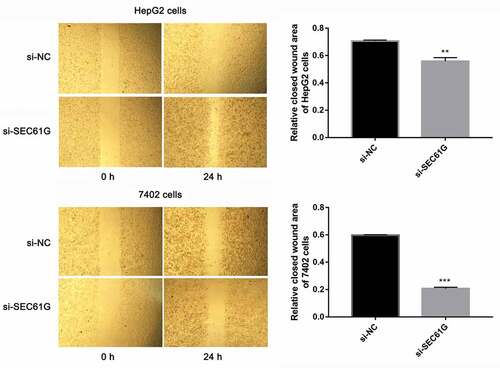 Figure 6. The role of SEC61G in wound healing of HepG2 and 7402 cells. The experiments were carried out for three times. Data are expressed as mean ± SD. ** P < 0.01 and *** P < 0.001 compared with si-NC group