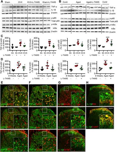 Figure 5 Oral L-TAMS inhibits the activation of NF-κB and upregulation of TNF-α and IL-1β in spinal dorsal horn of ovariectomized and aged mice. (A and C) Representative Western blots (A) and statistical analysis (C) show the protein levels of TNF-α, IL-1β, p-p65, total p65, p-IƘBα and IƘBα in spinal dorsal horn in Sham, Sham + L-TAMS, OVX, and OVX + L-TAMS groups (n = 4 per group). (B and D) Representative Western blots (B) and statistical analysis (D) show the levels of TNF-α, IL-1β, p-p65, total p65, p-IƘBα and IƘBα in spinal dorsal horn in control (8 weeks), Aged and Aged + L-TAMS groups (n = 4–5 per group). The data were analyzed by one-way ANOVA with Tukey’s test. *P<0.05, **P<0.01, ***P<0.001, vs Sham (Sh); #P<0.05, ##P<0.01 vs OVX; $P<0.05, $$P<0.01 vs Aged. (E–H) Representative confocal images of the double immunofluorescence staining show that p-p65 (E) and TNF-α (F) is mainly located in the nuclei and cytoplasm of dorsal horn neurons respectively, they are also expressed in small amounts in microglia (Iba1) and astrocytes (GFAP); The IL-1β (G and H) is mainly located in CGRP+ terminals but not in spinal dorsal horn neurons. Scale bar: 100 μm.