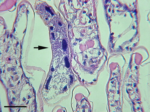 Figure 5. Synophrya sp. (arrow) in the gill lamella of Litopenaeus setiferus, collected in coastal Georgia (USA). This was the only Synophrya sp. observed after histological examination of several hundred white shrimp. H & E. Scale bar 50 µm.